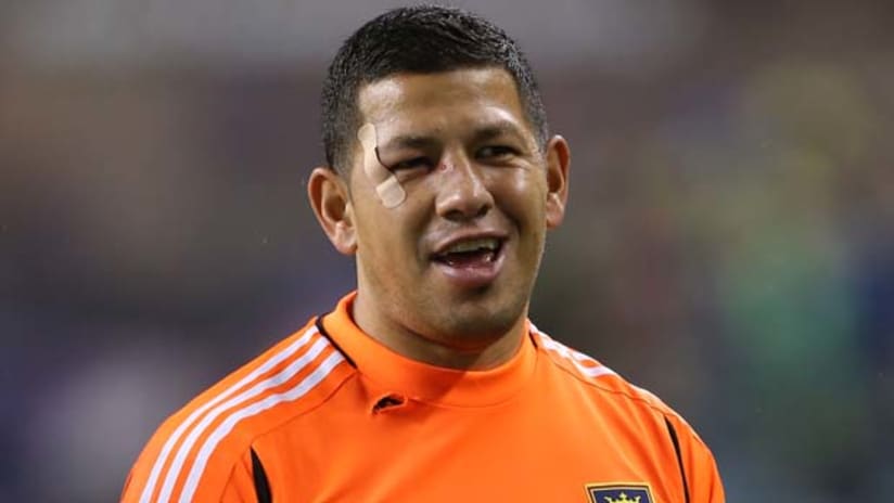 Nick Rimando is all busted up