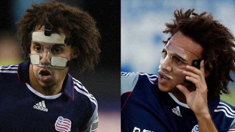 Kevin Alston's protective mask before, and after.