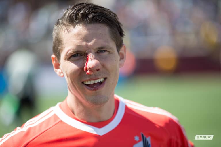 Loon Crush: Bobby Shuttleworth - Bobby Shuttleworth with a bloody nose